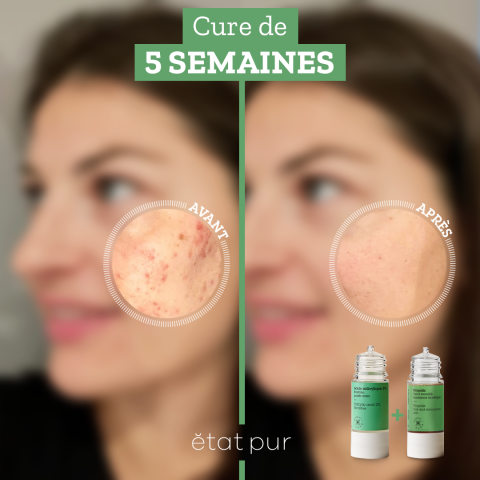 avant après Alexandrine