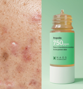 Propolis