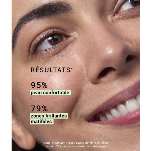 Zinc gluconate 3% 15 ml