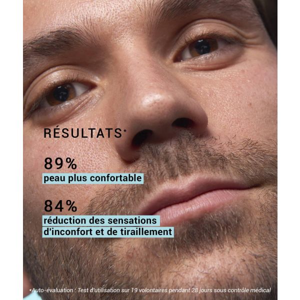 Aloe vera 0,5% 15 ml