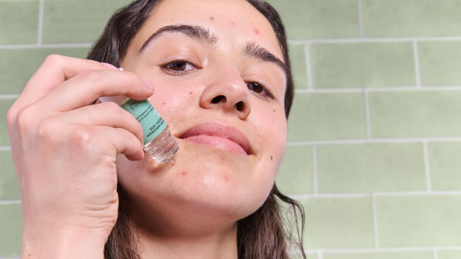 Acné et soleil : nos 6 conseils pour éviter la poussée de boutons après l’été