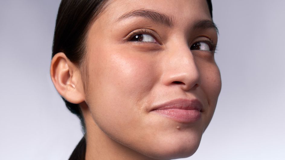 Acné à l'adolescence : quel traitement pour l'acné juvénile