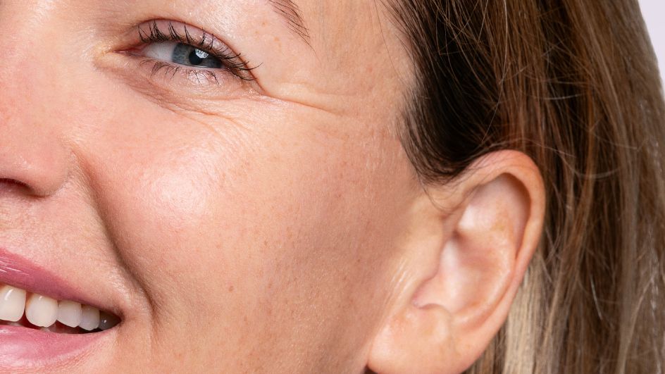 Le soleil et le vieillissement de la peau