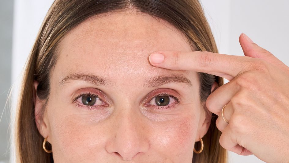 Taches brunes sur la peau : tout savoir